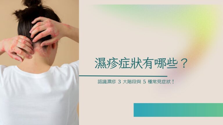 濕疹症狀