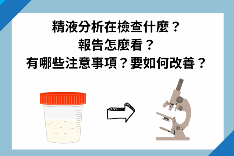 精液分析