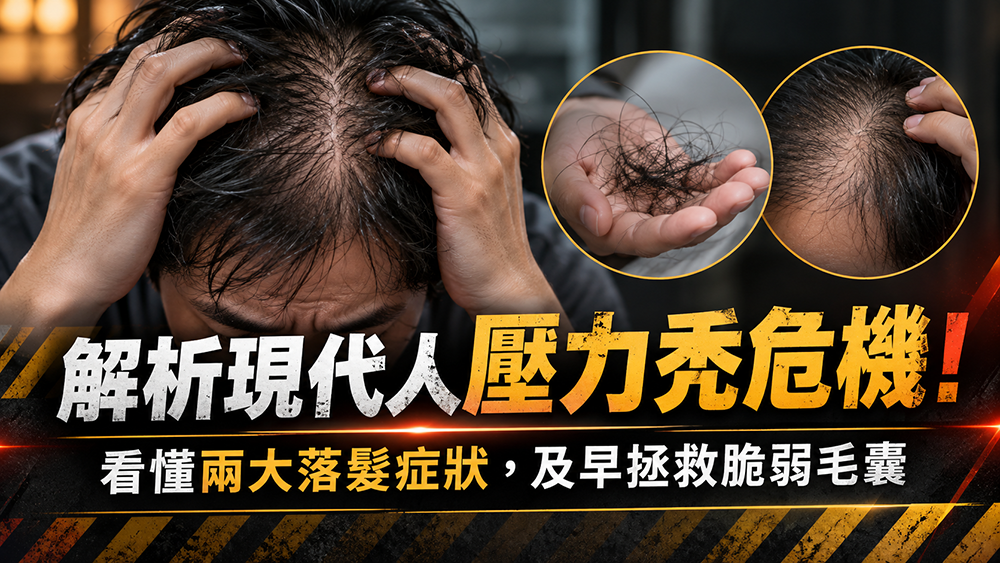解析現代人壓力與落髮！看懂兩類常見落髮表現與就醫時機